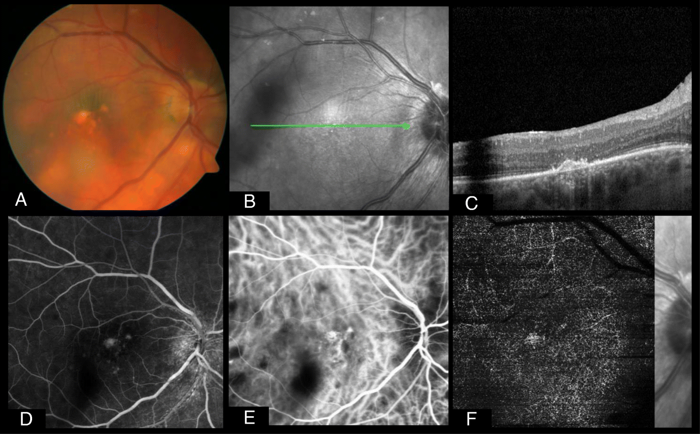 Fig. 1