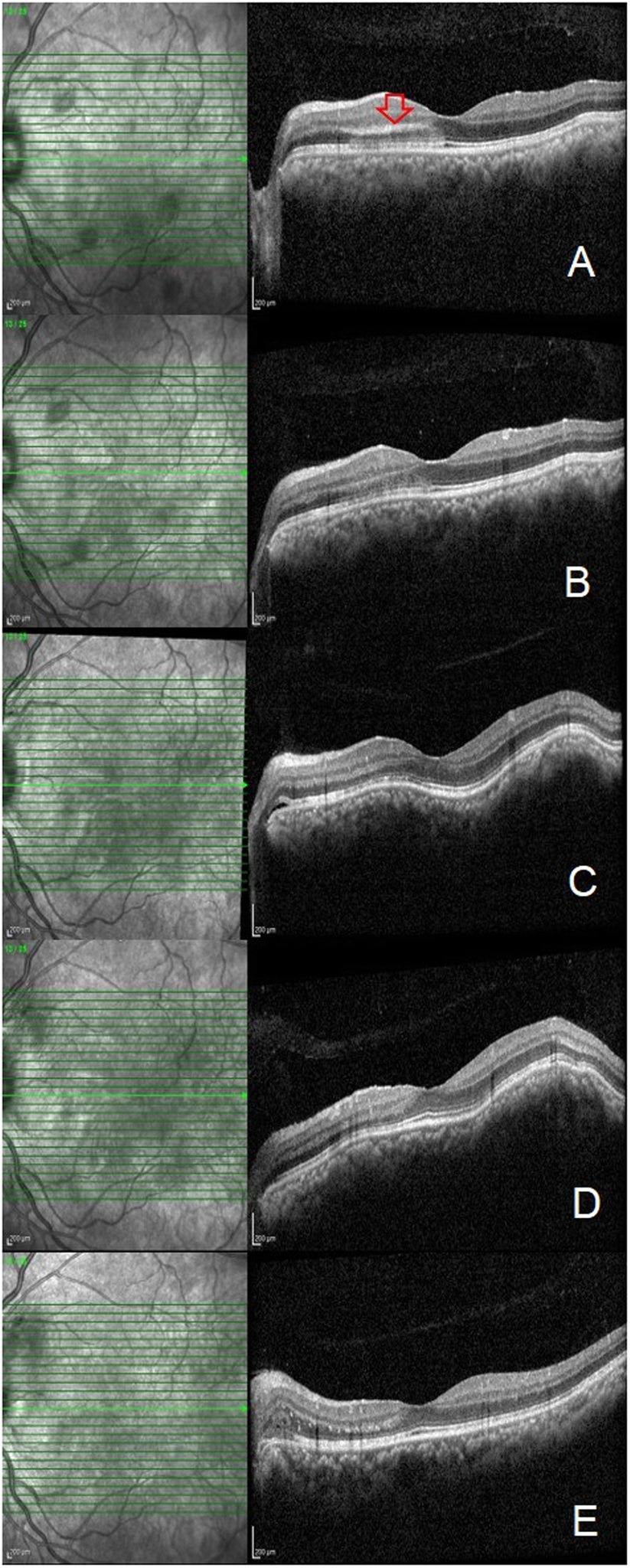 Fig. 2