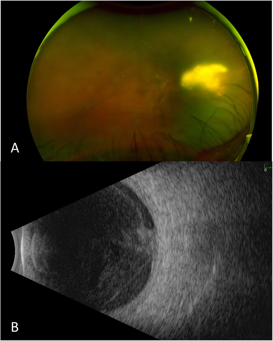 Fig. 1