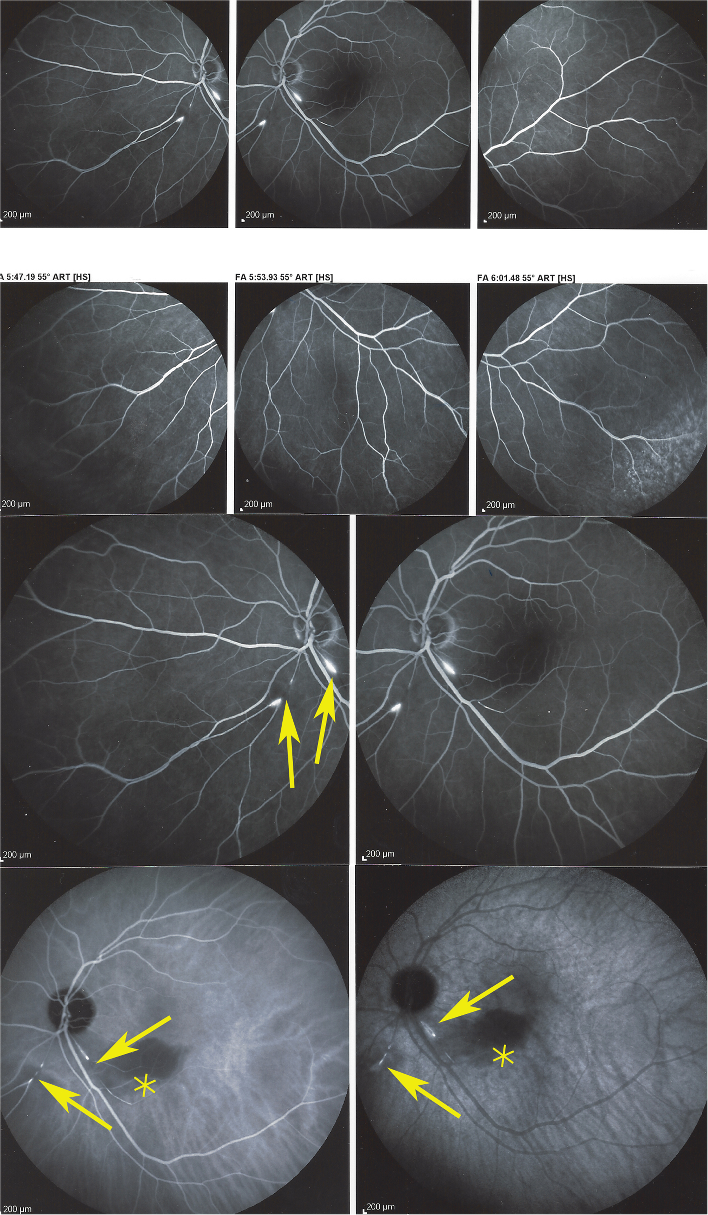 Fig. 11