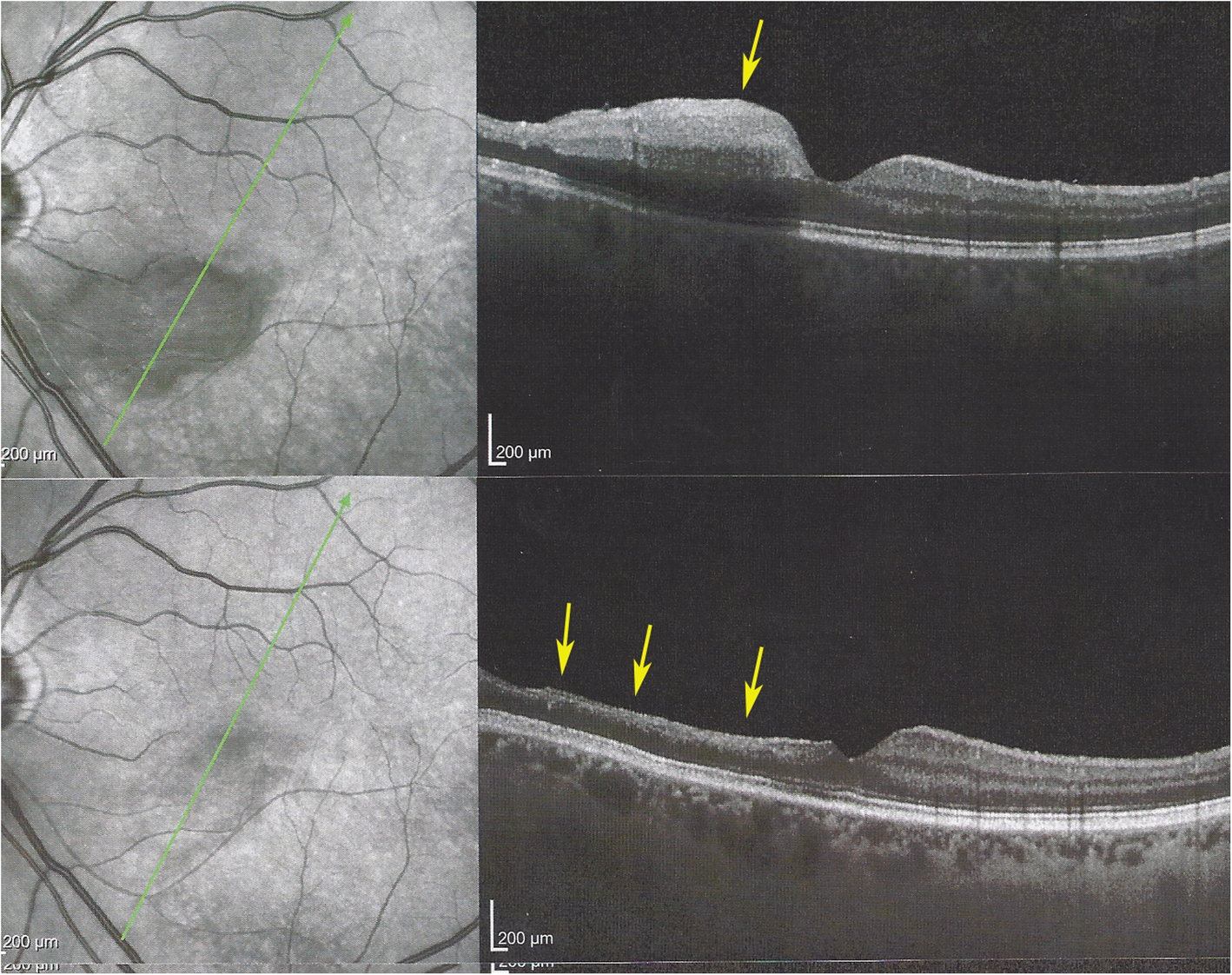 Fig. 12