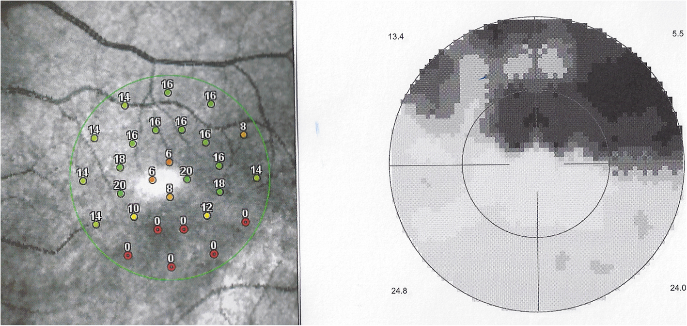 Fig. 15