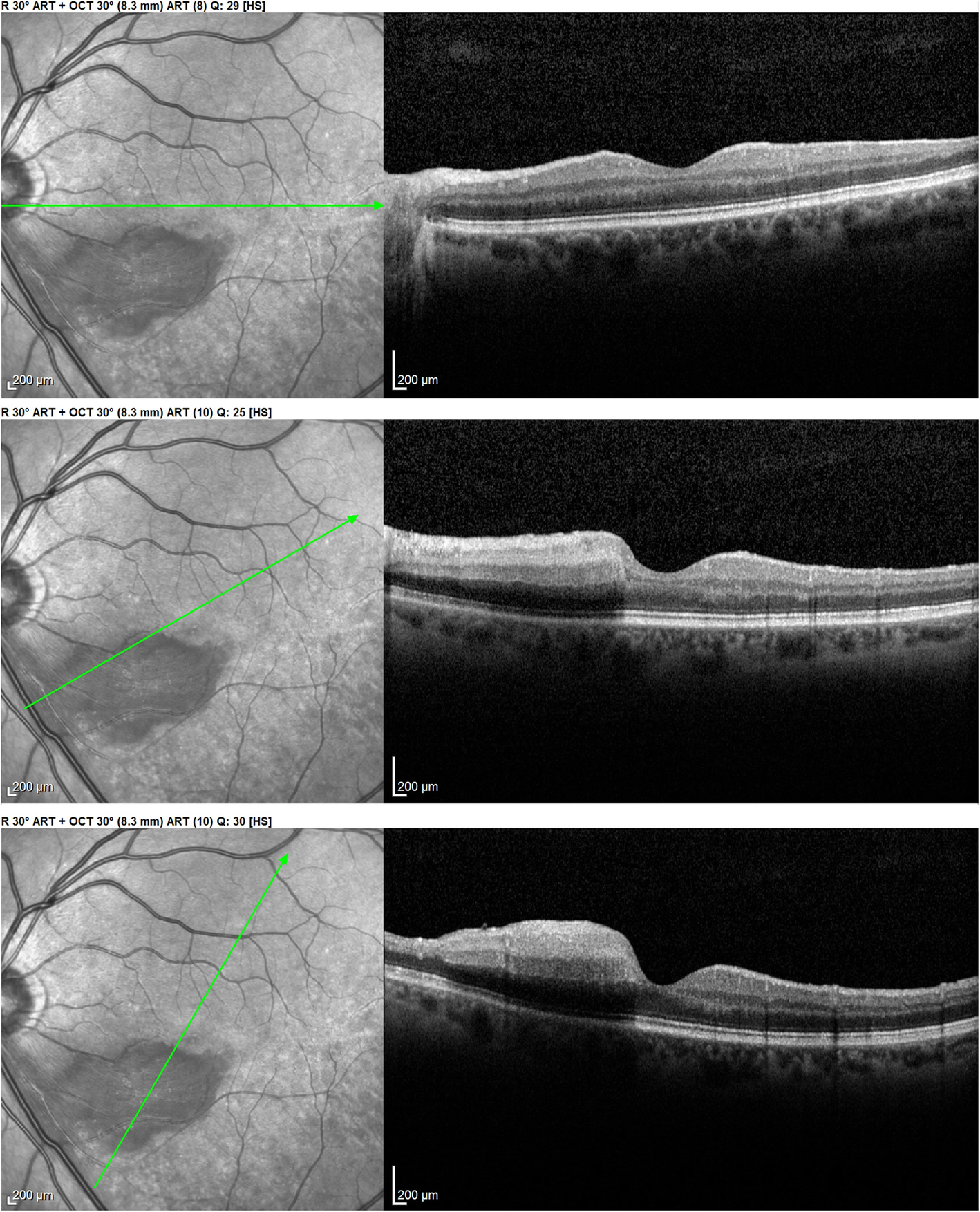 Fig. 3