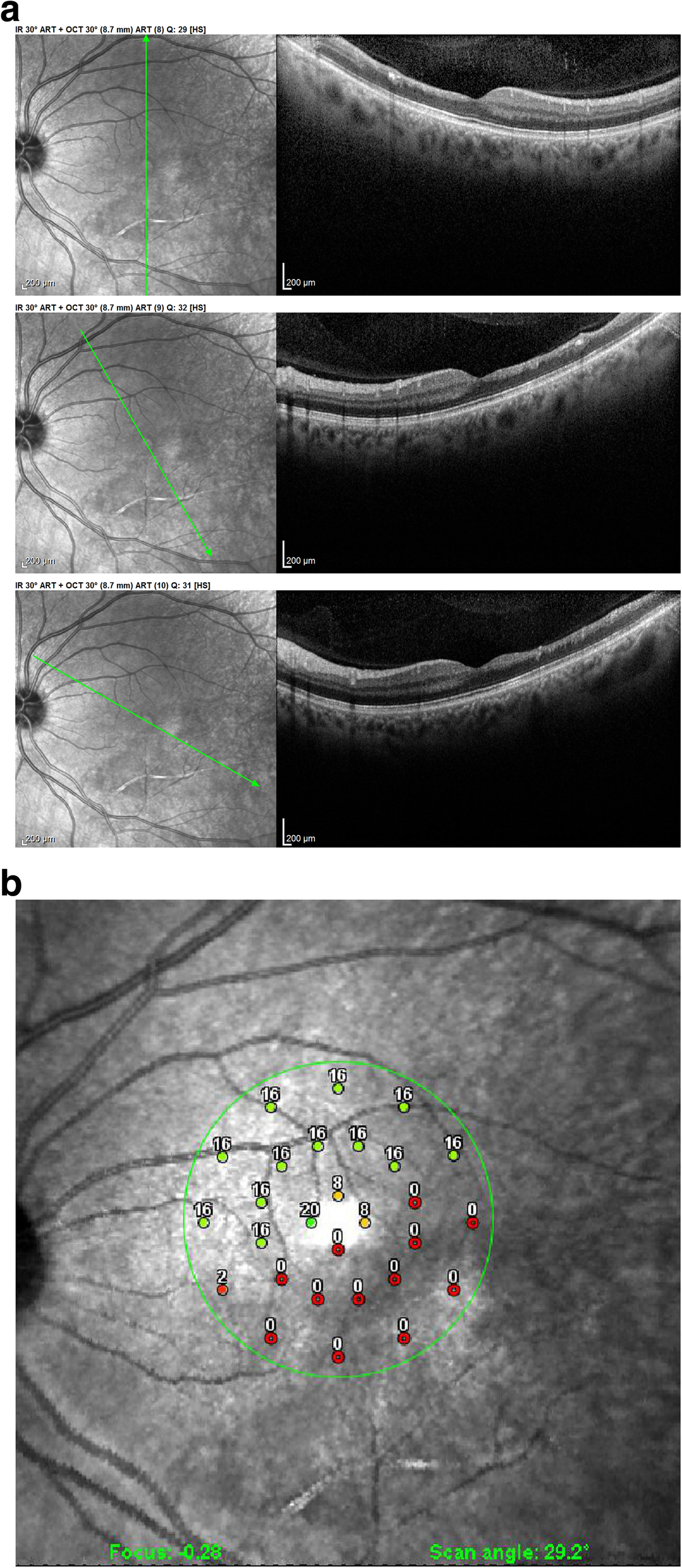 Fig. 4