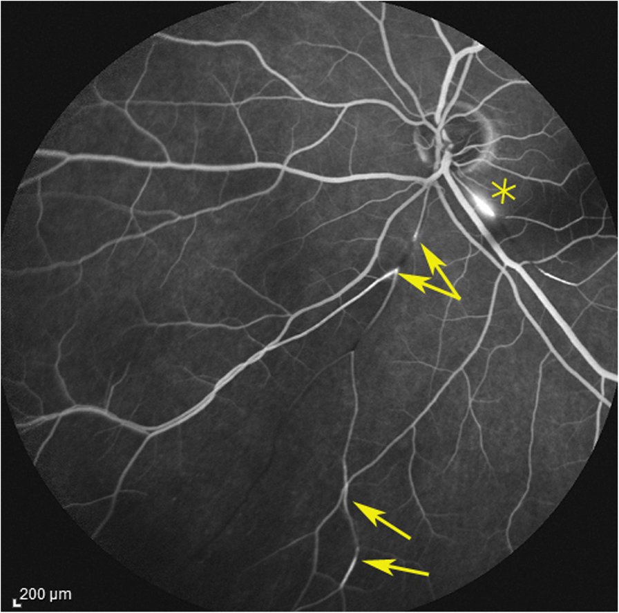 Fig. 5