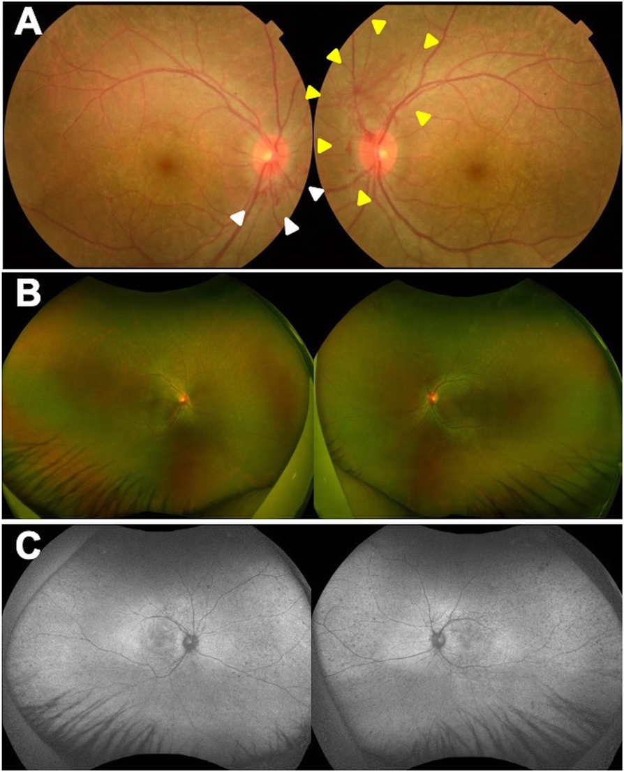 Fig. 1