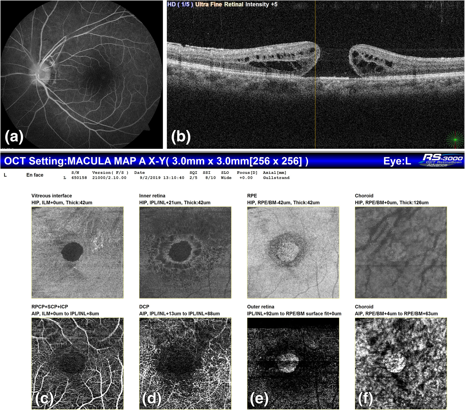 Fig. 2