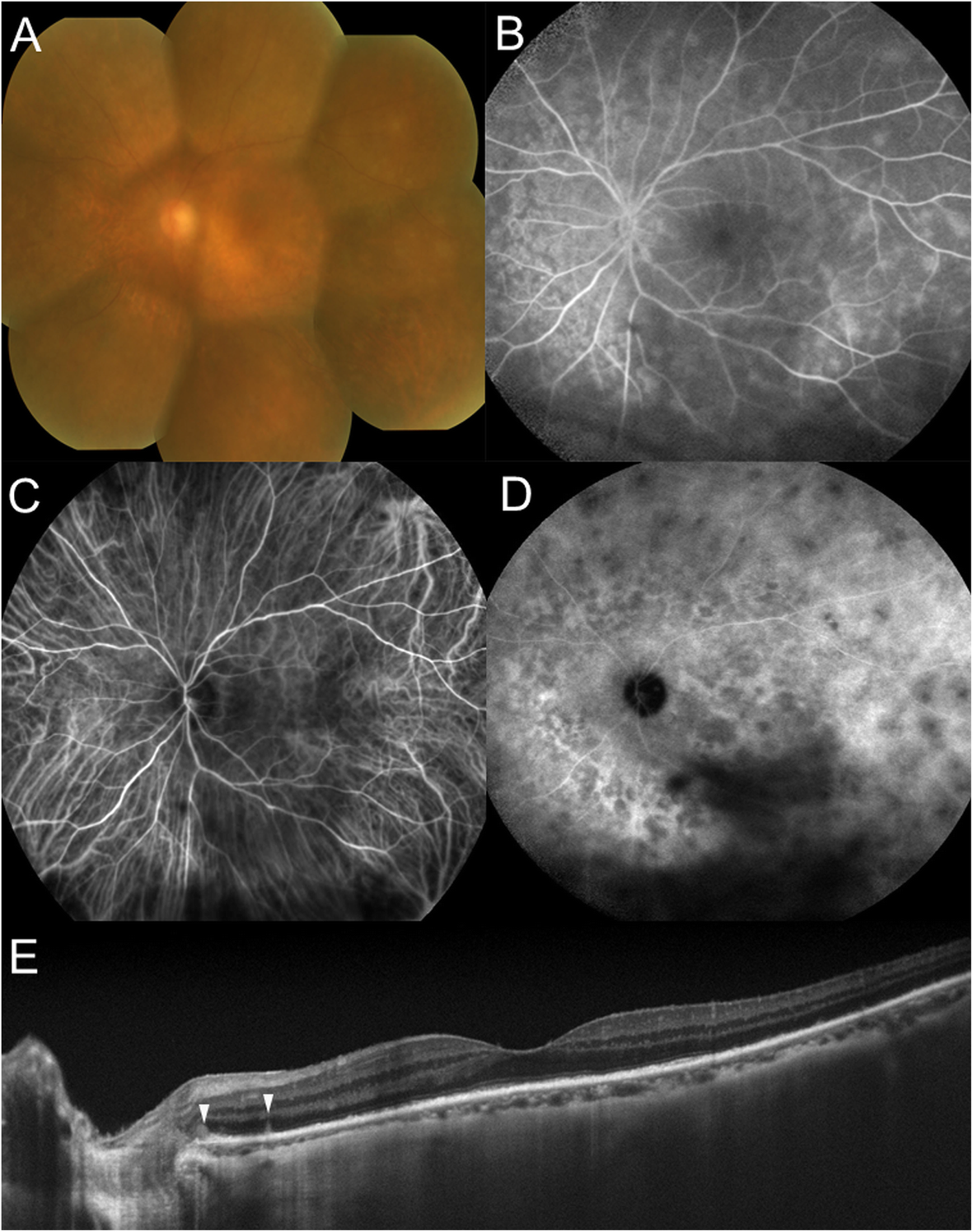 Fig. 1