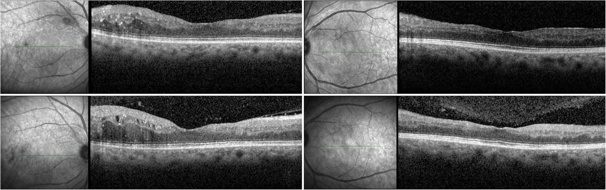 Fig. 3