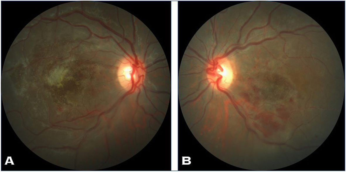 Fig. 2