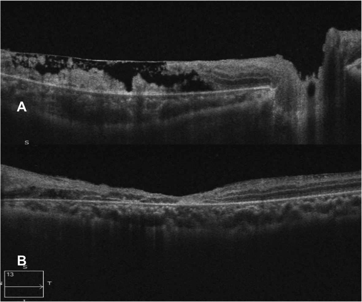 Fig. 3