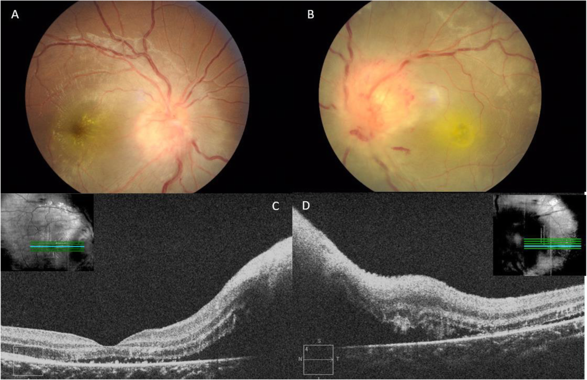 Fig. 4