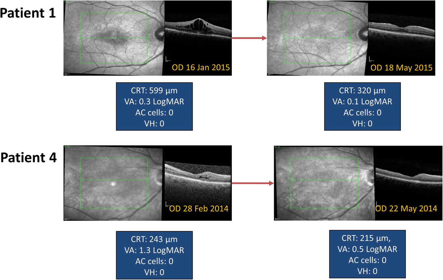 Fig. 4