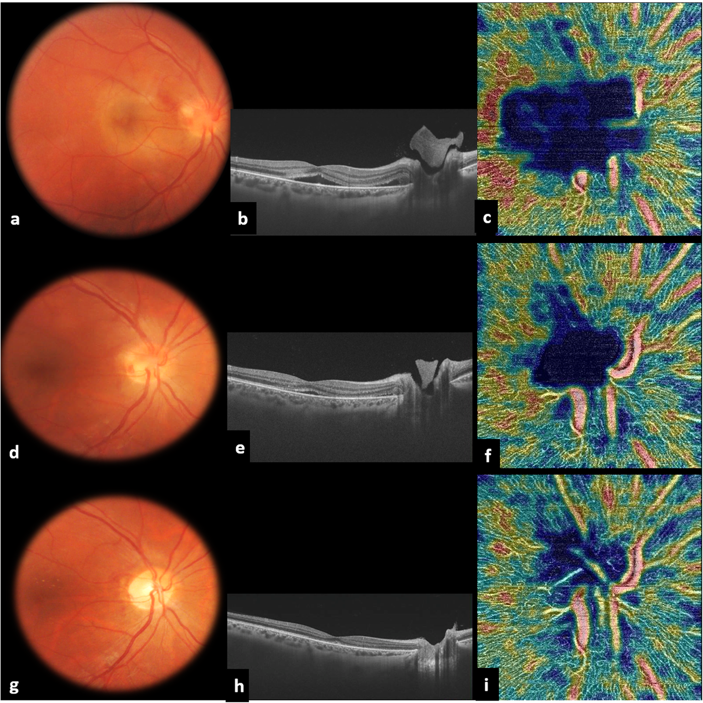 Fig. 2