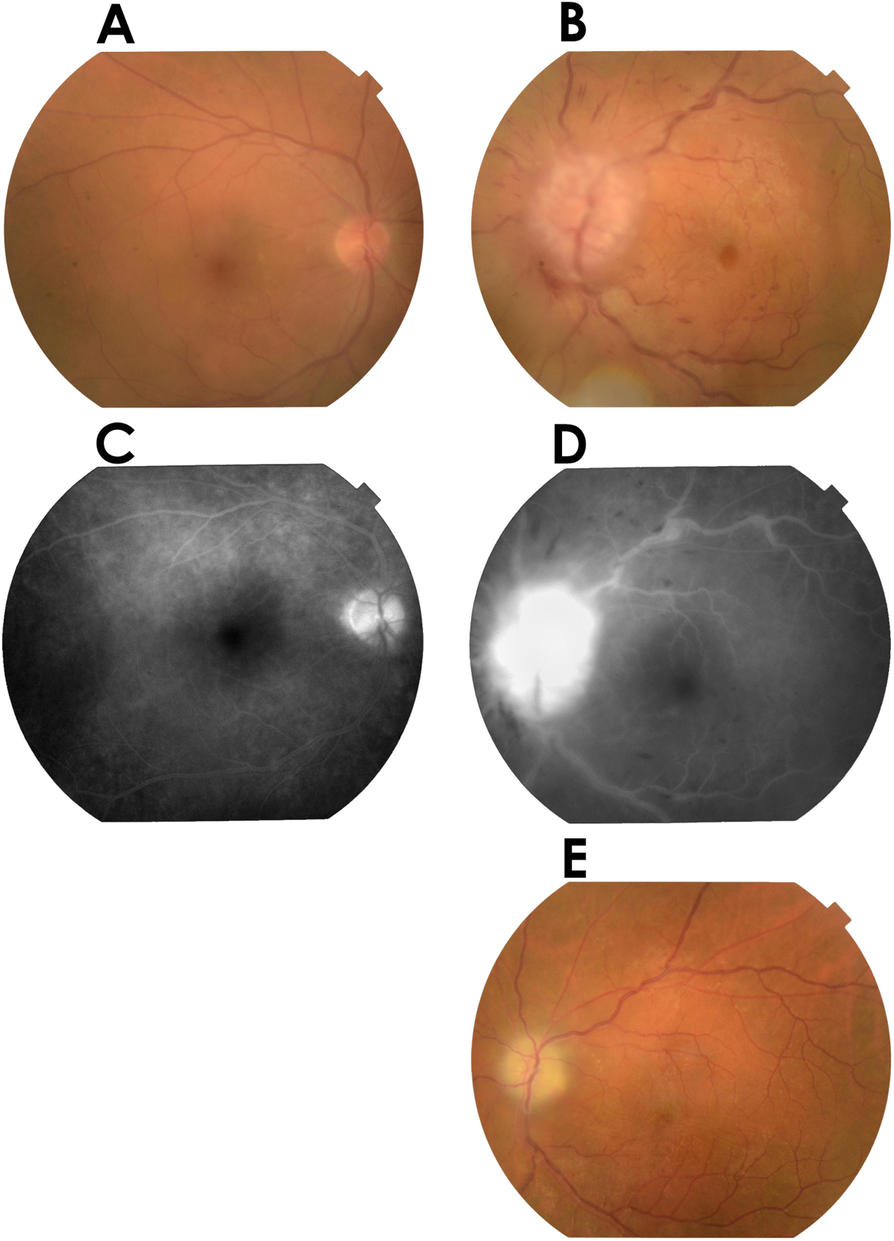 Fig. 1