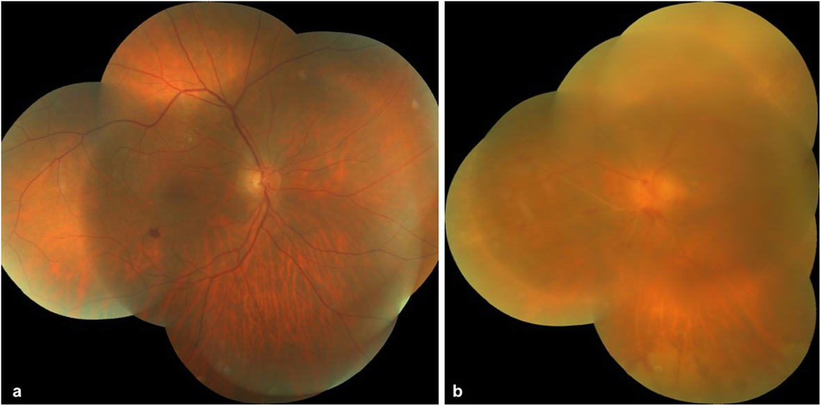 Fig. 4