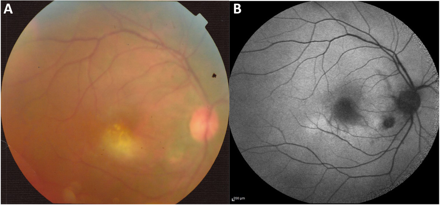 Fig. 1