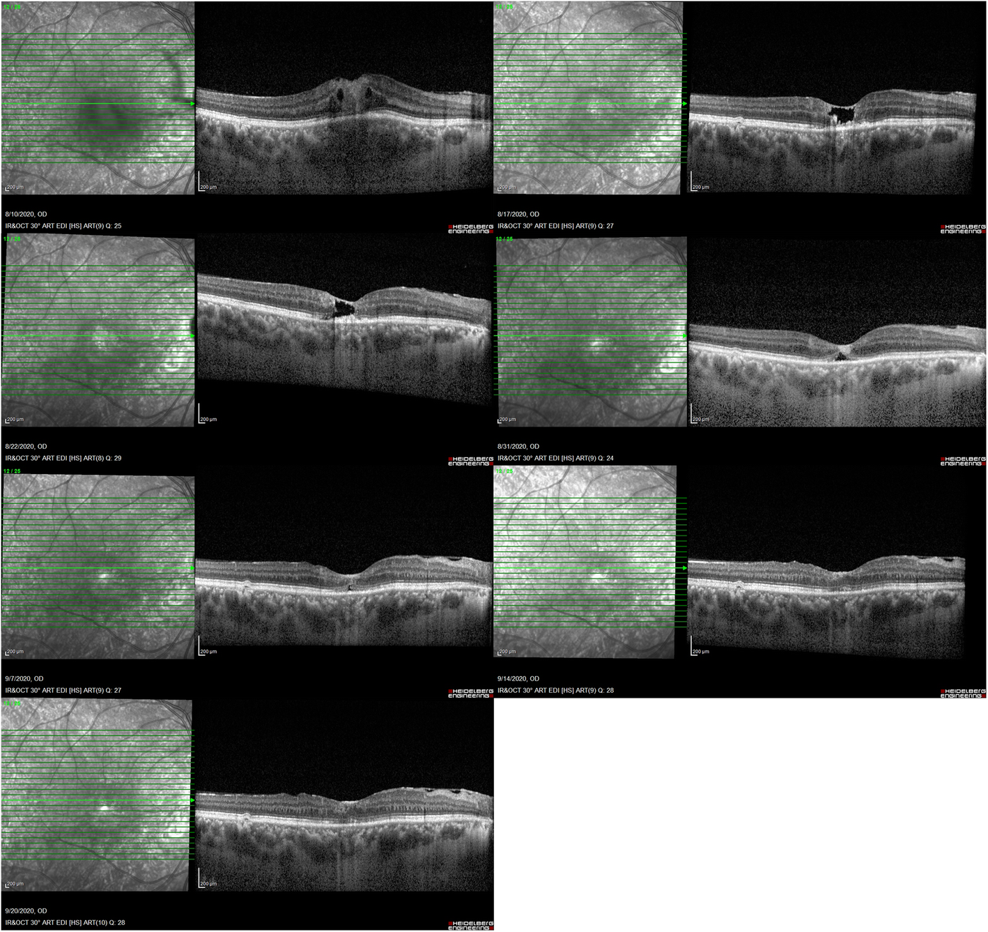 Fig. 3