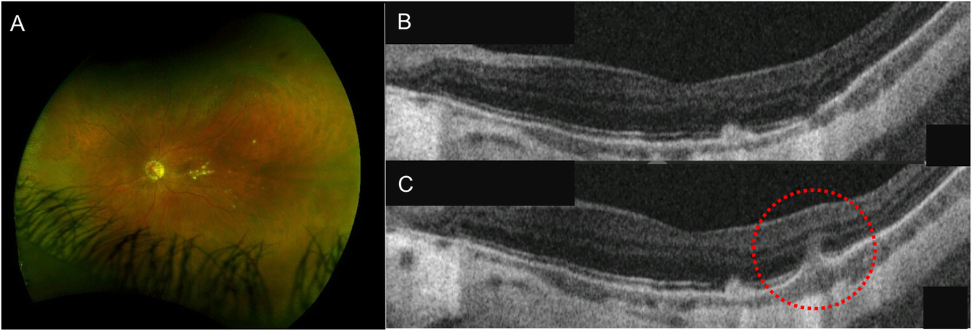 Fig. 4