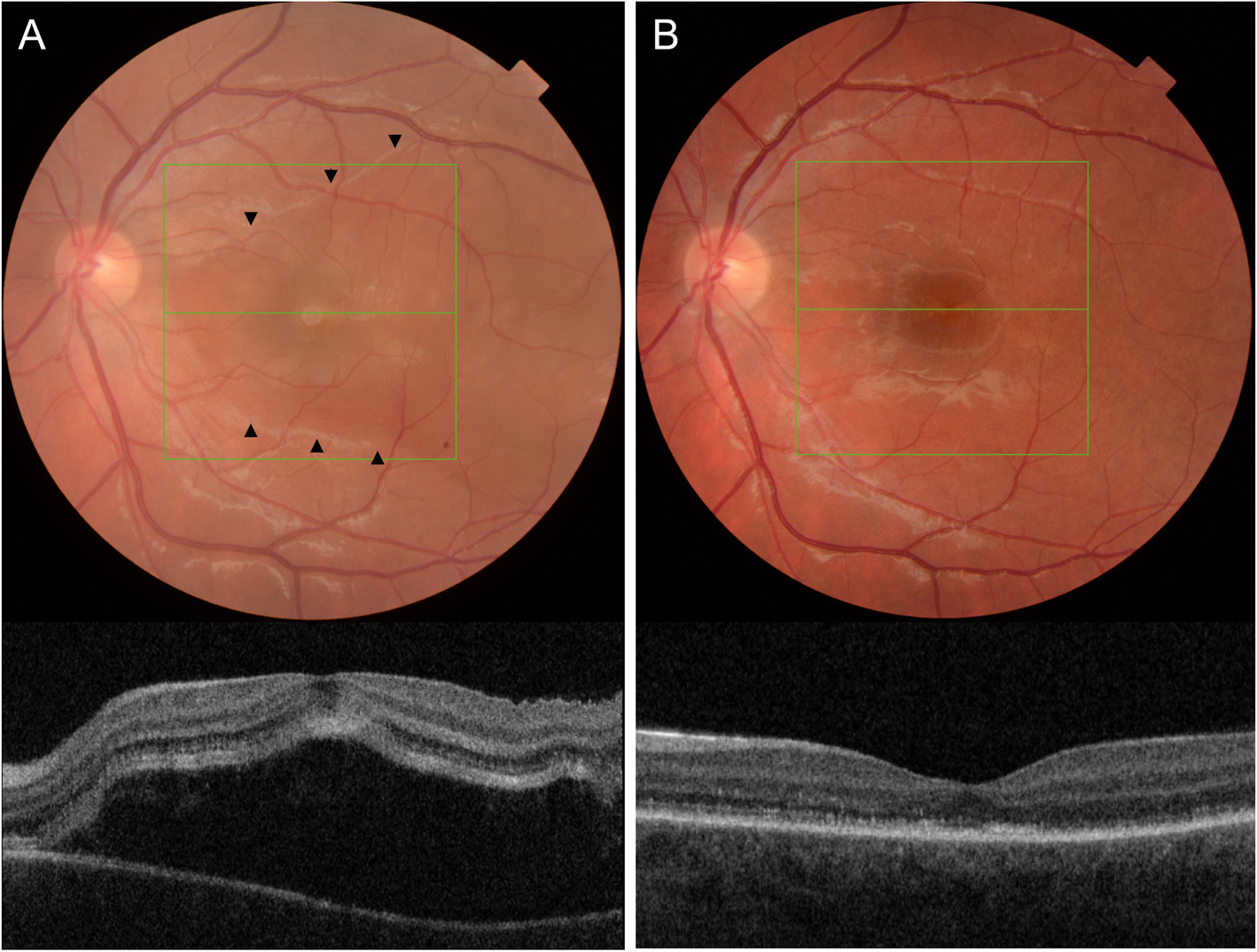 Fig. 3