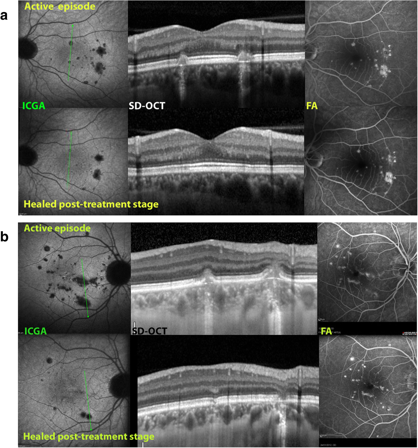 Fig. 11