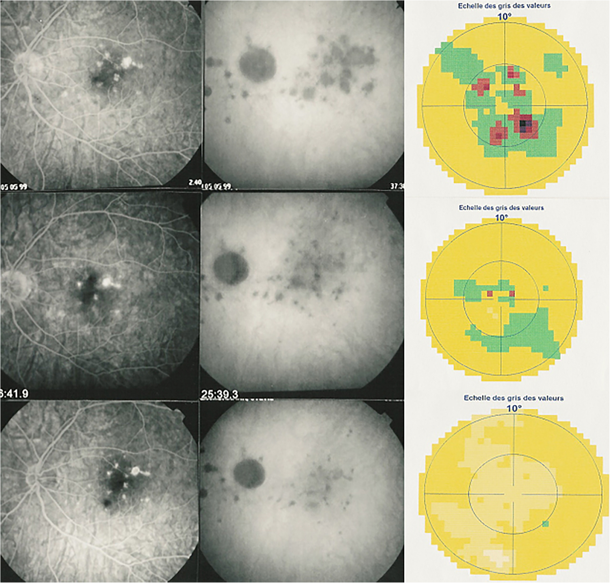 Fig. 12