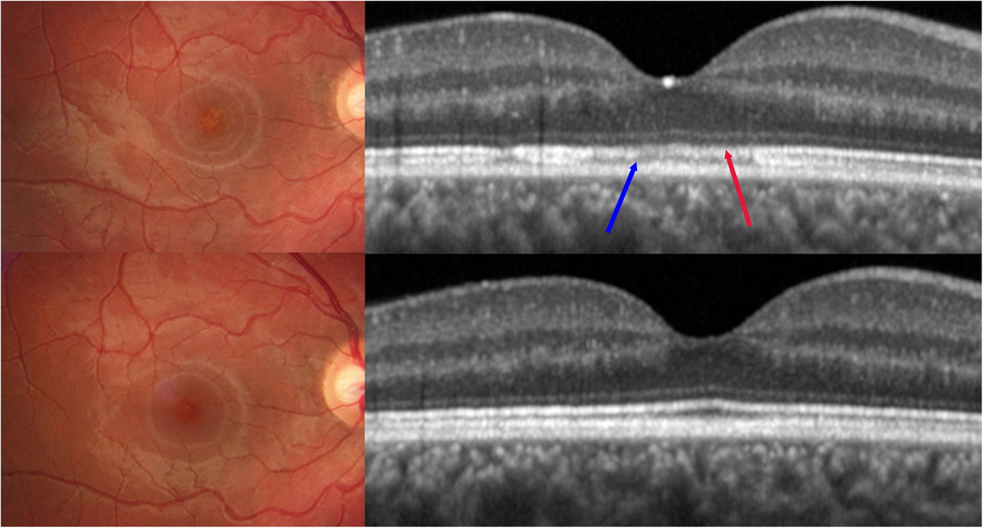 Fig. 2