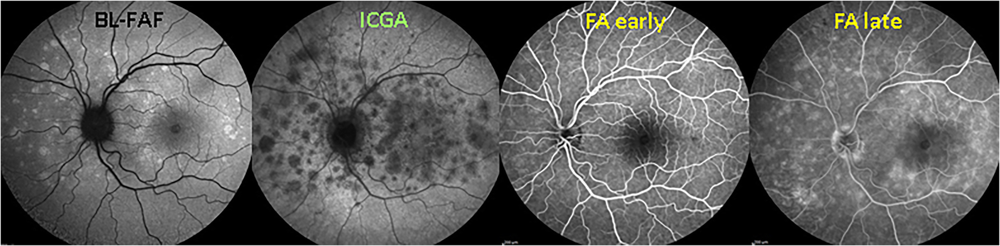 Fig. 5