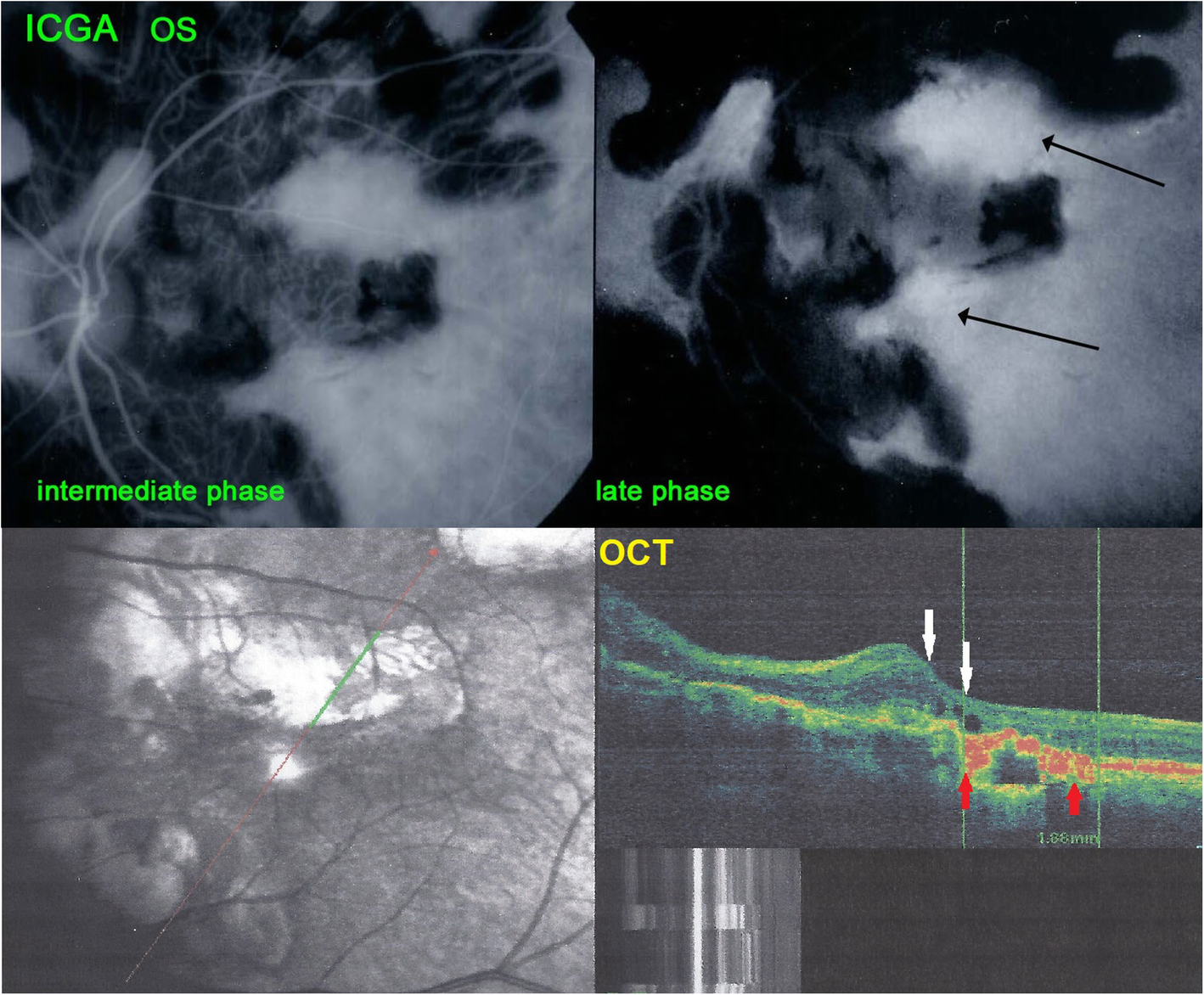 Fig. 11