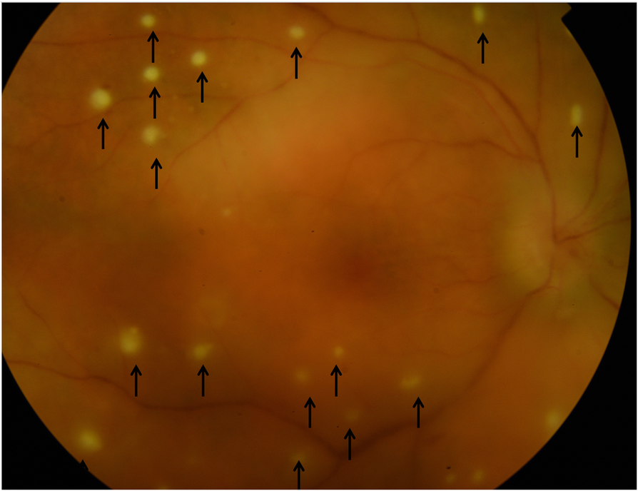 Fig. 2