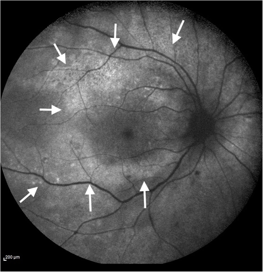 Fig. 5