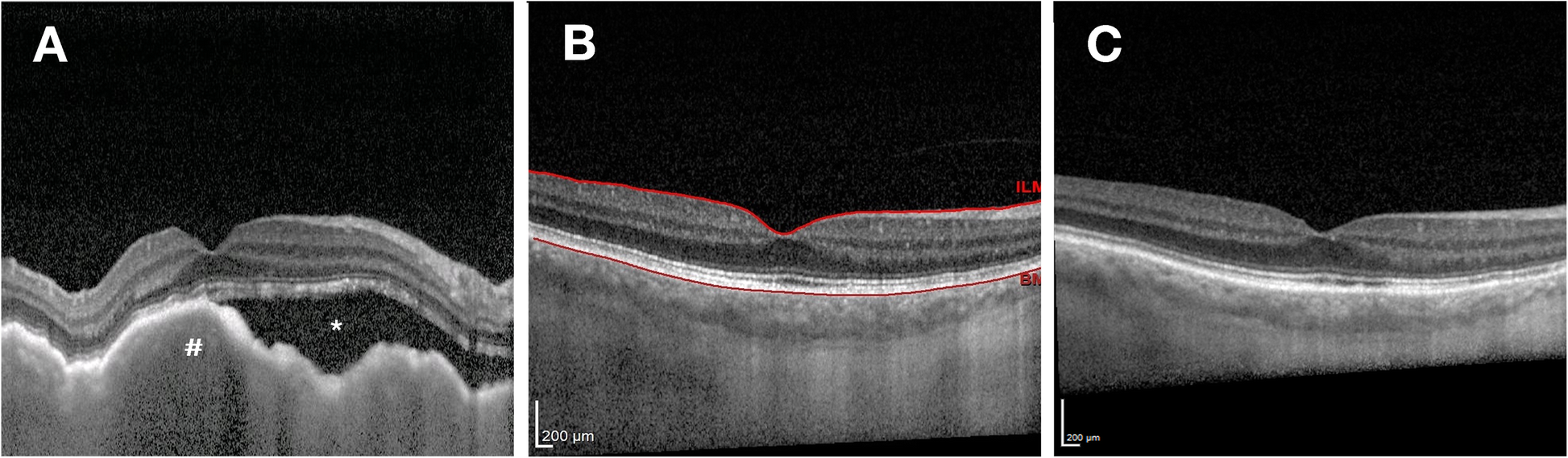 Fig. 4