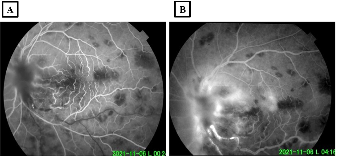 Fig. 2