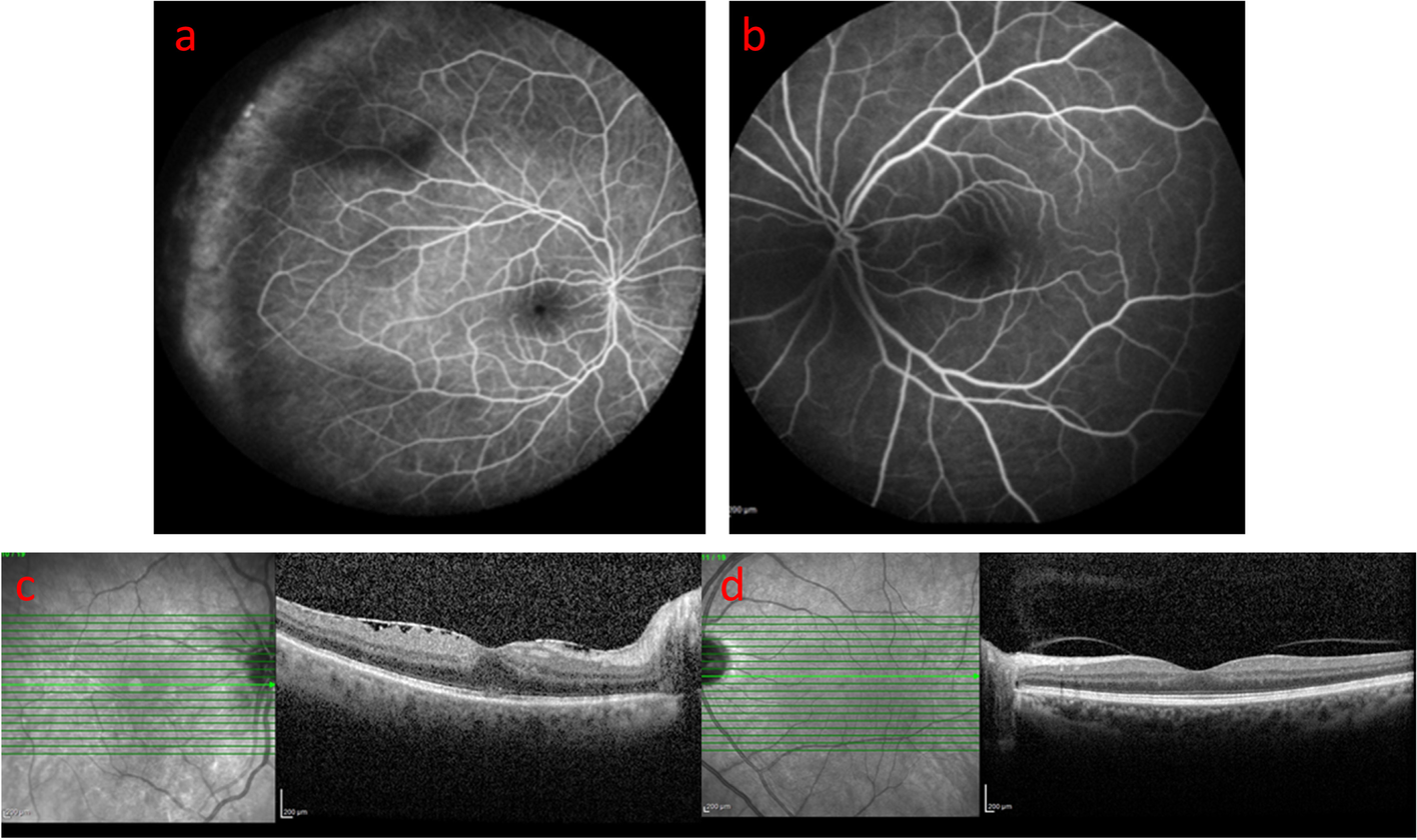 Fig. 4