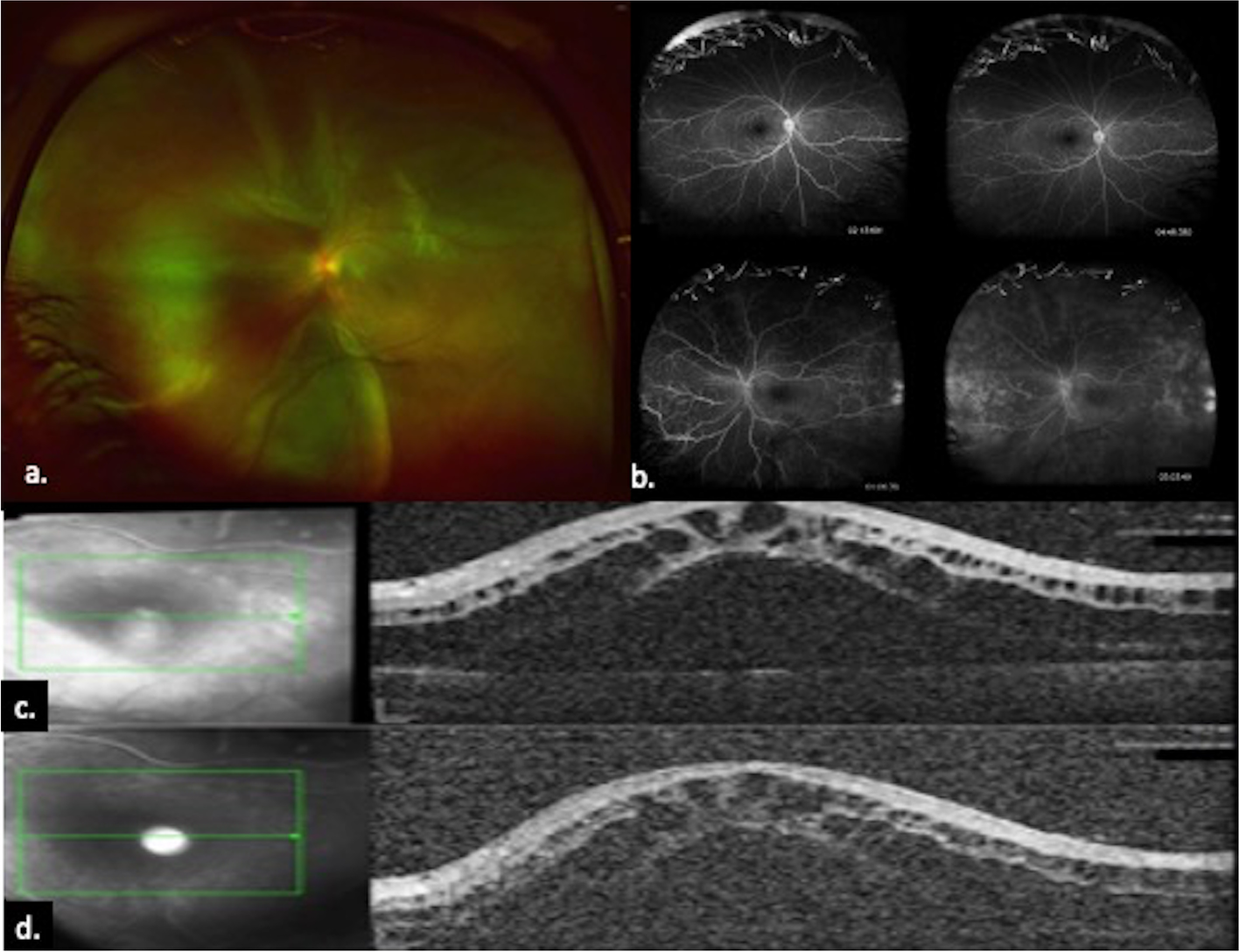 Fig. 1