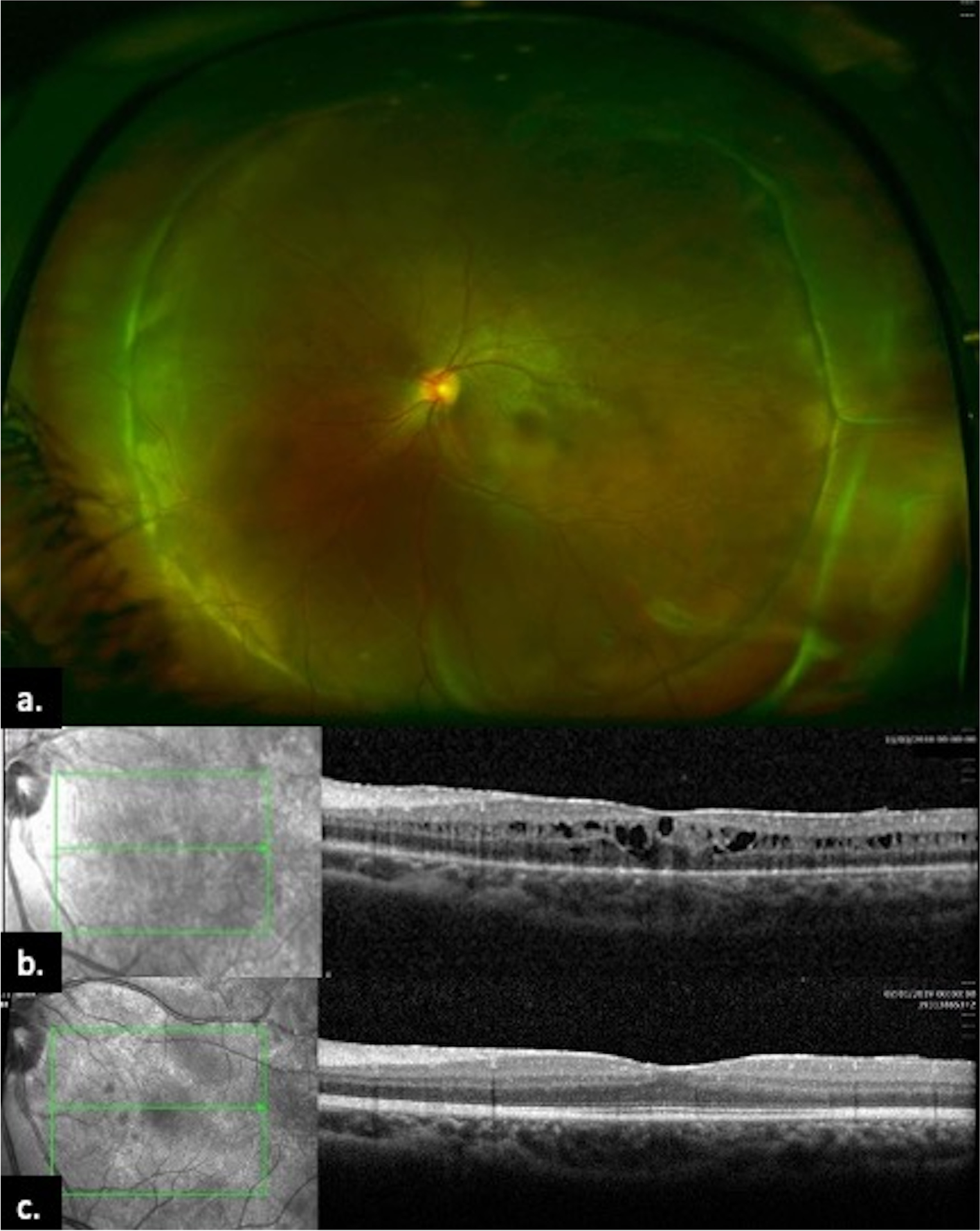 Fig. 2