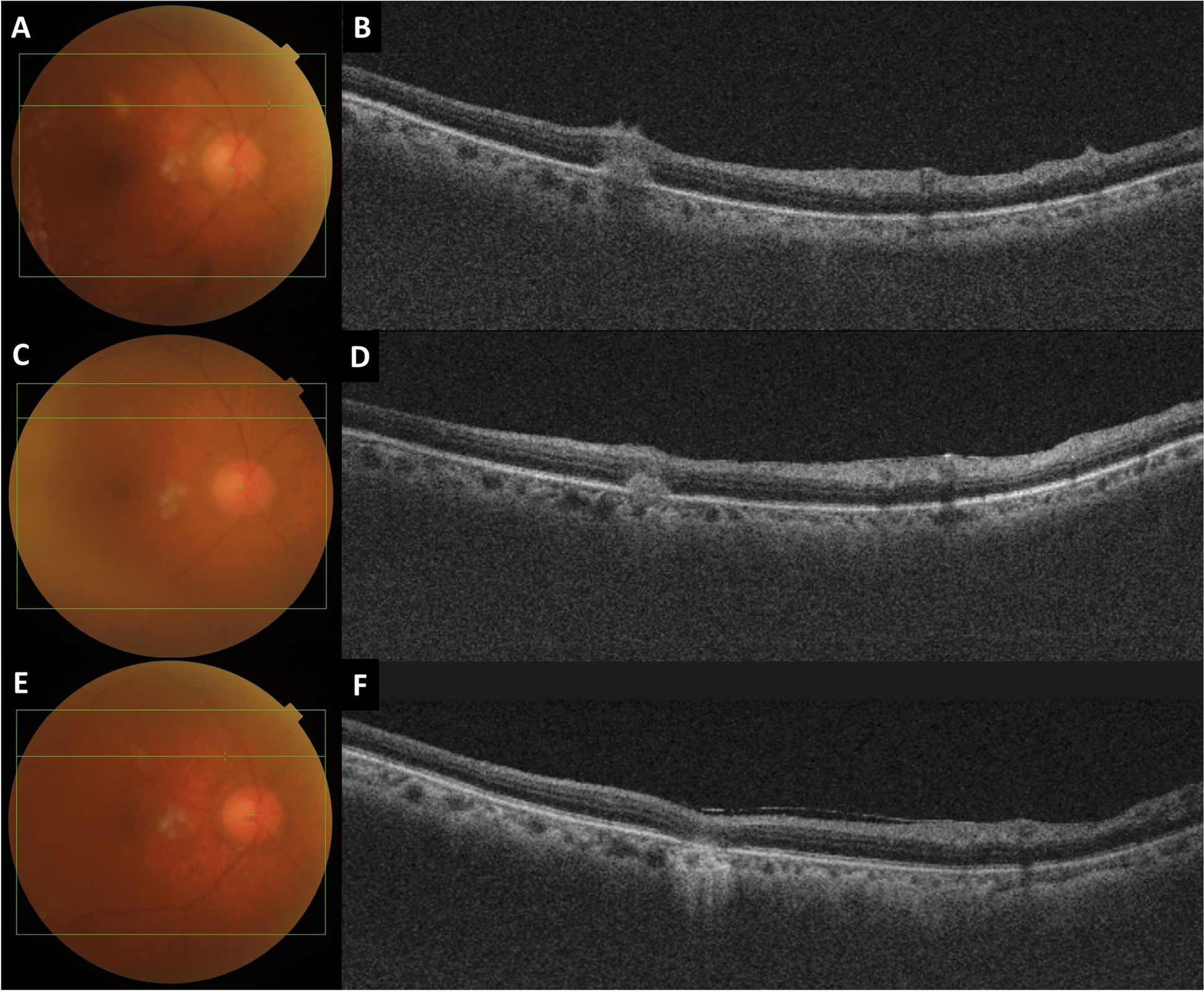 Fig. 3