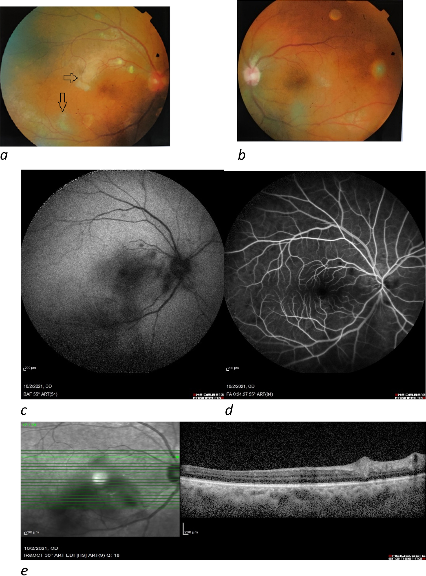 Fig. 3