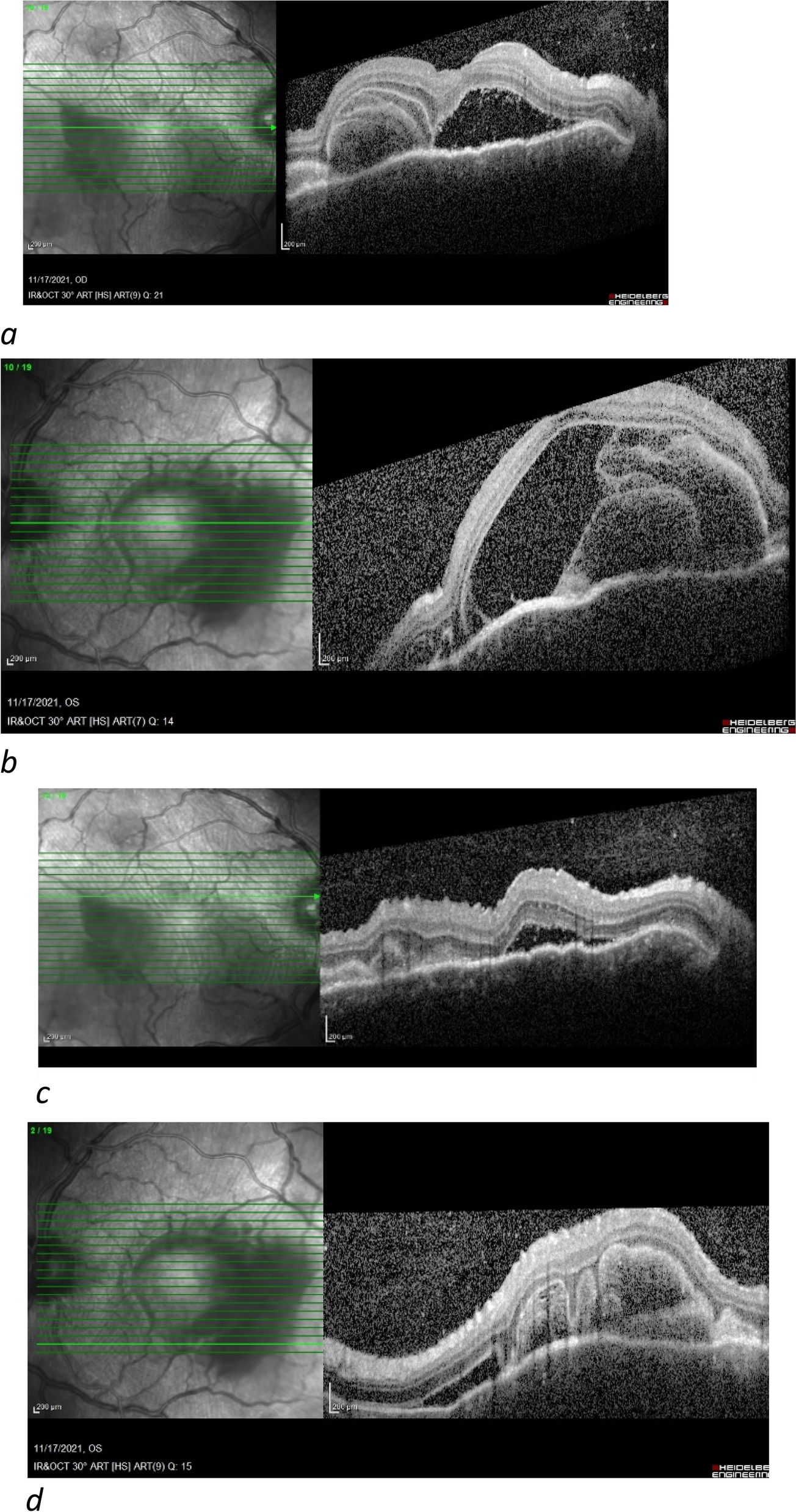 Fig. 5