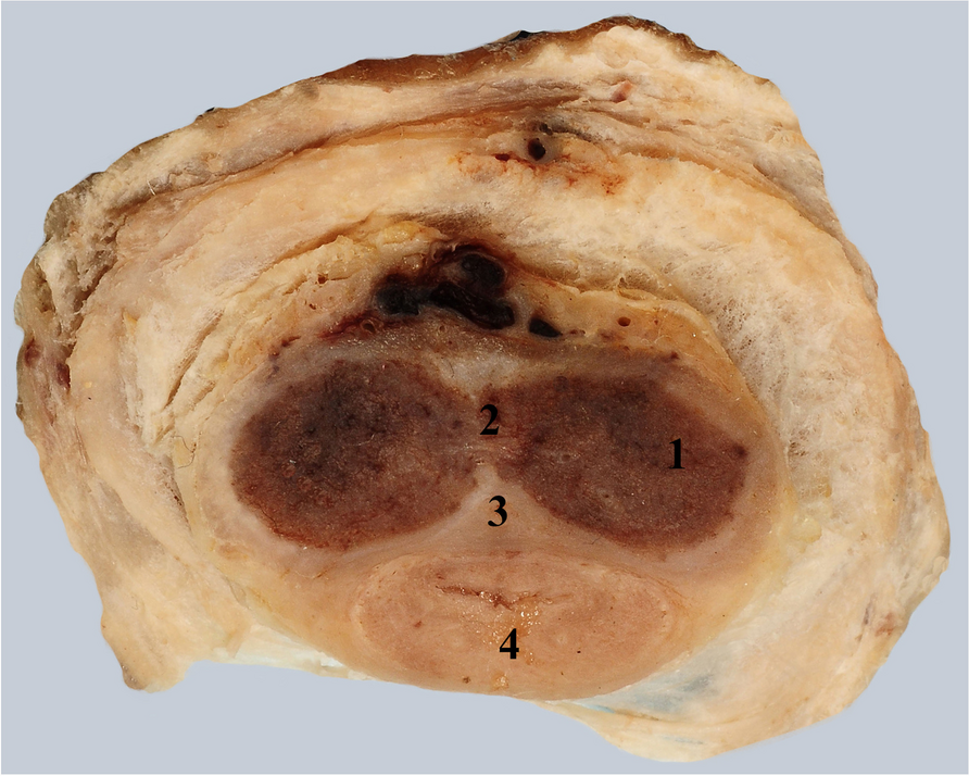 Fig. 7