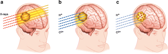 Fig. 1