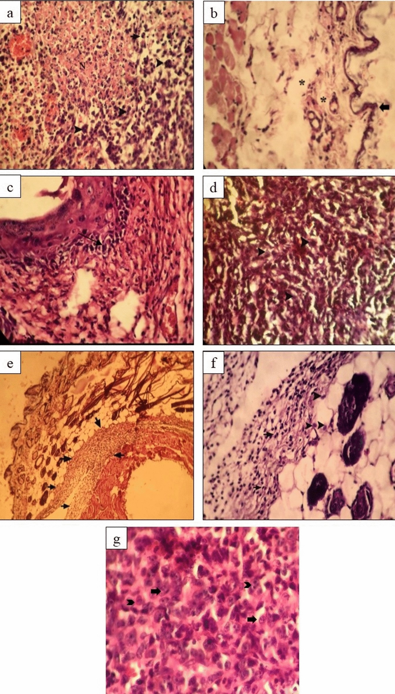 Fig. 13