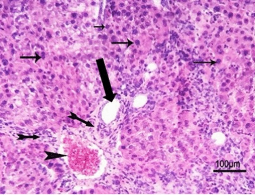 Fig. 14