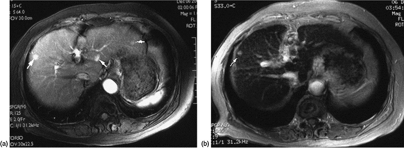 Fig. 9