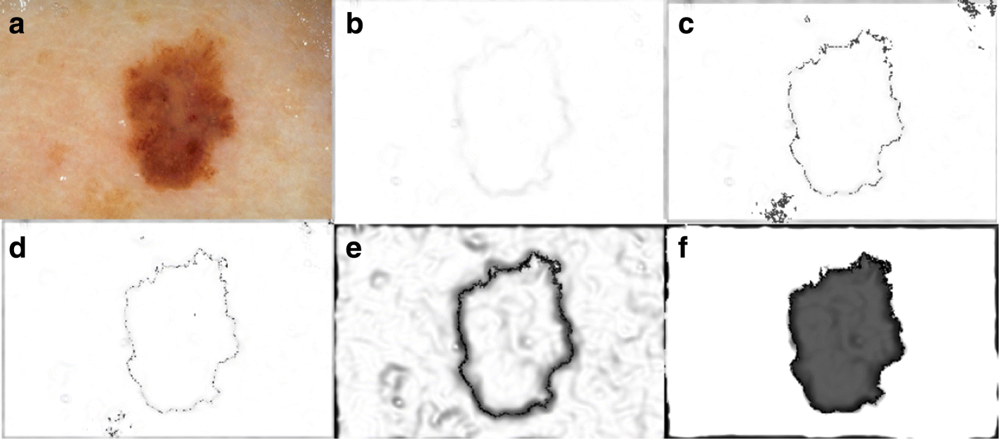 Fig. 6