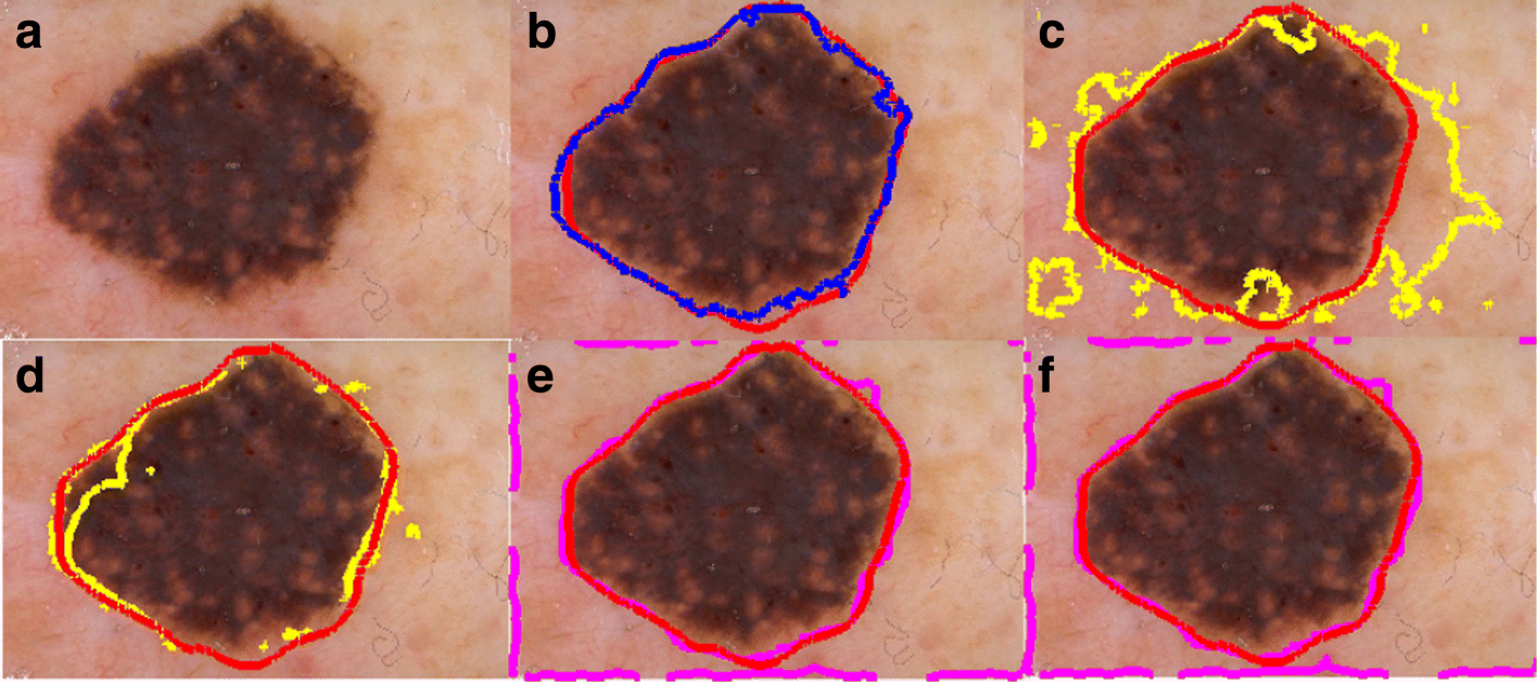 Fig. 9