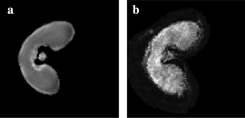 Fig. 11