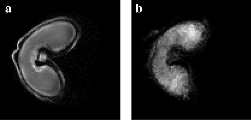 Fig. 12