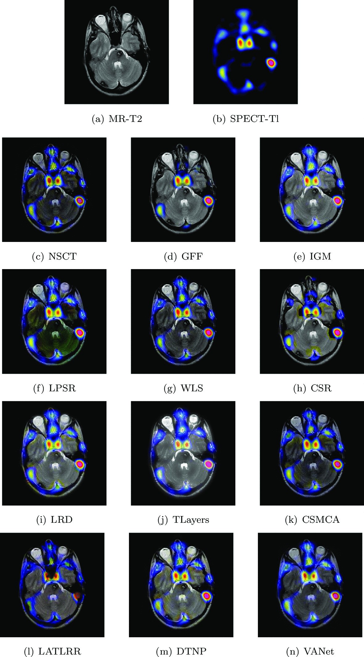 Fig. 12