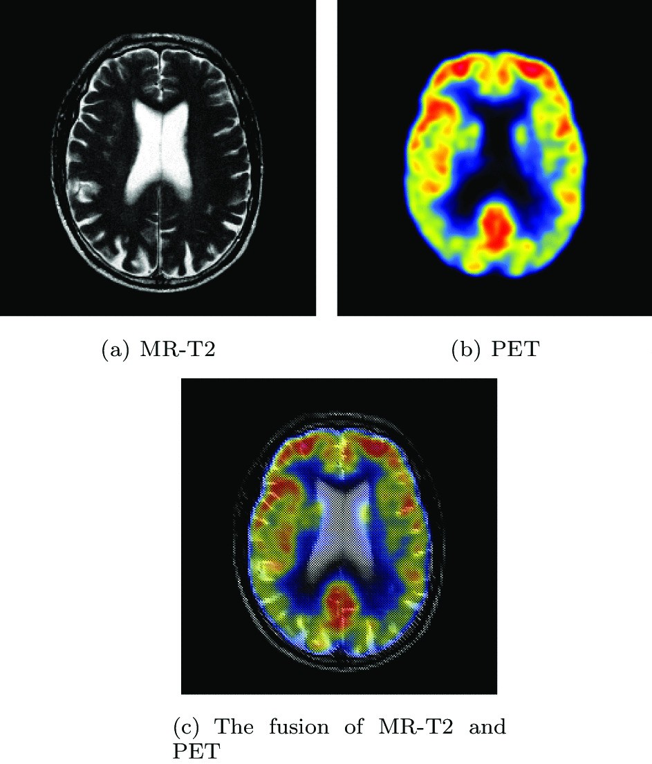 Fig. 1